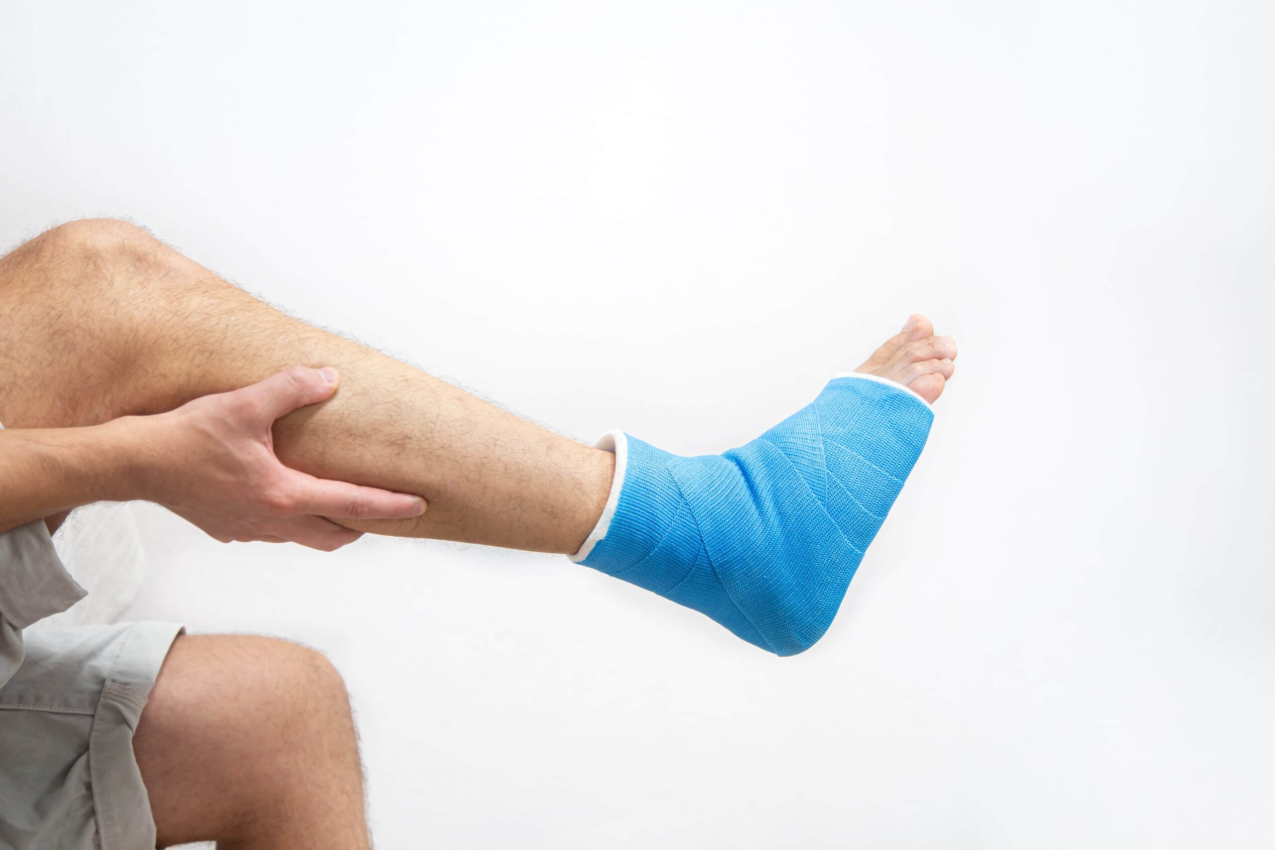 blue-splint-ankle-bandaged-leg-cast-male-patient-white-background-isolated-sports-injury-concept-min(1)